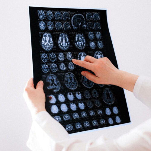 Neurología
