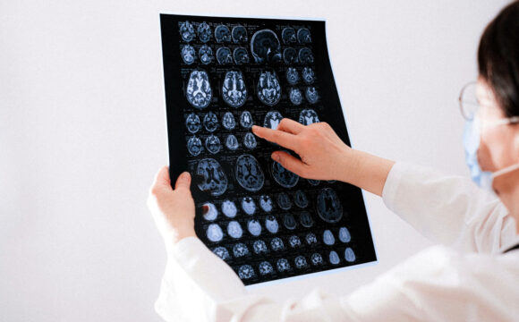 NEURO3 Neurología